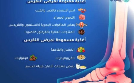 عيد الاضحى "والنقرس"
