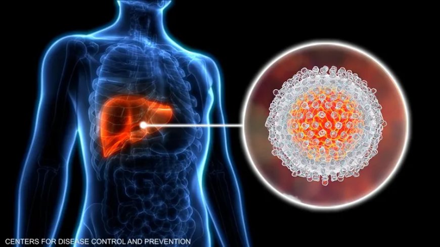 في اليوم العالمي للالتهاب الكبدي.. هذه طرق الوقاية والعلاج