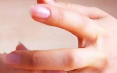 سوريا السابعة عربيأ بين الدول الأكثر انتشارا لحالات الطلاق