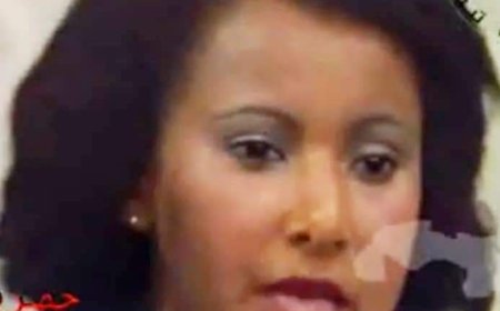 جلطة دماغية تدخل عضوة فرقة الانشاد جمعة محمد العناية المركزة بالمستشفى الكوبي