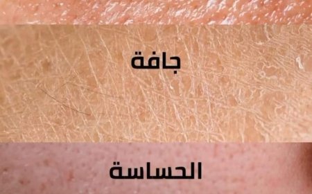 نصائح مهمة حول انواع البشره وكيفية الاعتناء بها.