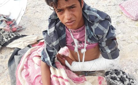 عصابة تعتدي بالضرب المبرح على الطفل فؤاد الزريقي في مدينة التربة بتعز 