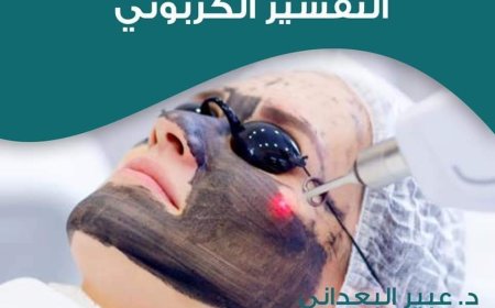 ماذا تعرف عن تقنية التقشير الكربوني..؟!