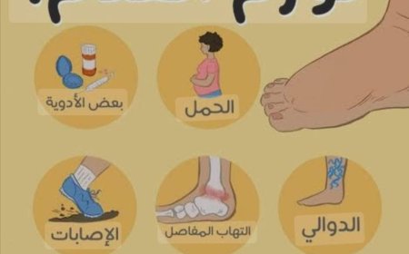 نصائح قد تساعد في تخفيف #تورم #القدمين :