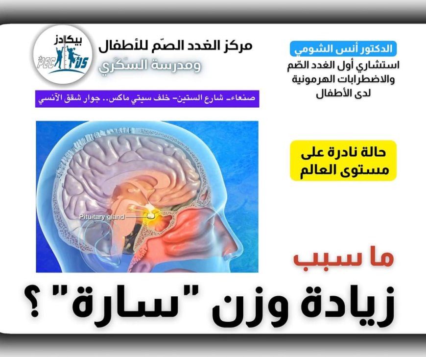 طبيب يمني يكتشف حالة نادرة على مستوى العالم..كيف تم ذلك..؟! 