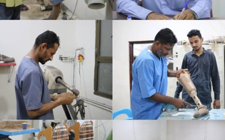 مدير مركز الأطراف الصناعية نعمل جاهدين على تقديم خدماتنا بطاقم فني متخصص