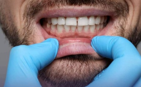 (ثقافة صحية ) هل لاحظت من قبل تغير لون للثة لديك؟