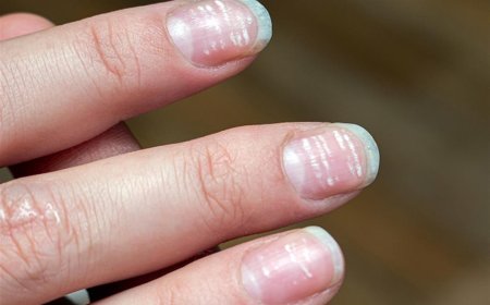 (ثقافة صحية) تحذر من ظهور الأظافر بهذه الألوان: لها دلالات 