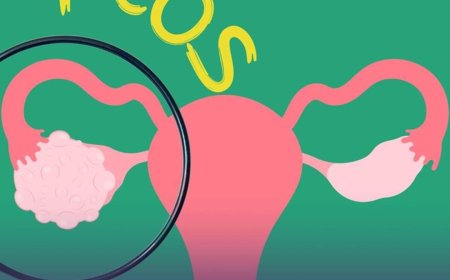 (ثقافة صحية) متلازمة_تكيس_المبايض !!