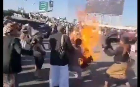 مواطن يشعل النار بجسده في ميدان السبعين بالعاصمة صنعاء (صور) 
