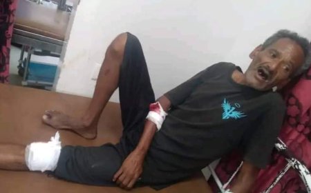 تعز.. اصابة ثلاثة مدنيين بقذيفة حوثية على المدينة السكنية بمديرية المظفر