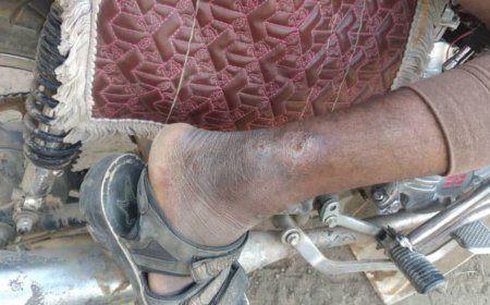 كارثة بيئية وصحية في قرية السامقة يتسببها مشاريع سقي القات.