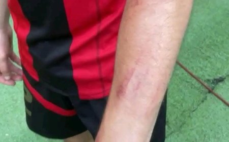 تعرّض بعثة اتحاد العاصمة الجزائري إلى اعتداءات عقب نهاية مباراة الفريق أمام جراف السنغالي