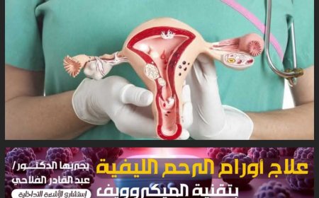 (ثقافة صحية) #الأورام الليفية في #الرحم أعراضها وعلاج الحقن بالقسطرة الشريانية!!