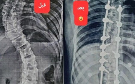 طبيب عدني يحقق انجاز طبي غير مسبوق