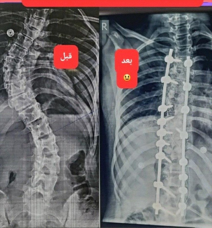 طبيب عدني يحقق انجاز طبي غير مسبوق