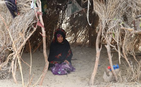 إمرأة تحتاج إلى عملية جراحية للعيون ..!!
