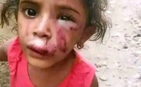 ام تعذب طفلتها بطريقة وحشية في تعز.