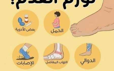 تورم_القدمين هل هو أمر عادي أم تحذير صحي ؟