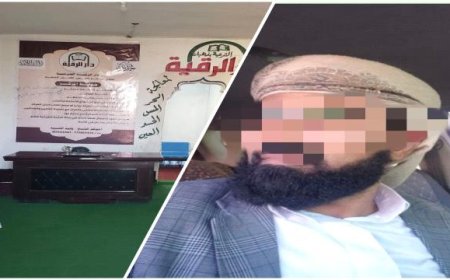 ضبط مشعوذا يستدرج نساء ويستغلهن جنسياً تحت مبرر علاج السحر والعين في تعز ."صورة"