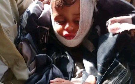 وفاة طفل جراء احراق منزل مواطن من قبل مجهولين في تعز