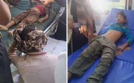 أبين. وفاة طفلين في حفريات مشروع صرف صحي بزنجبار.. تفاصيل