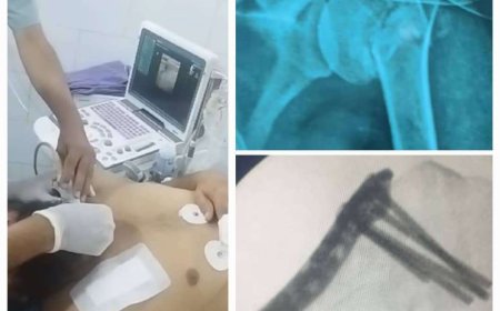 لأول مرة في عدن فريق طبي ينجح باجراء عملية نوعية باستخدام التخدير الطرفي