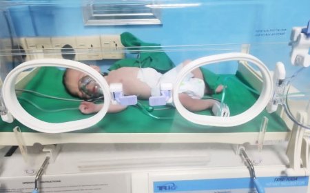 المستشفى اليمني السويدي للامومة والطفولة بتعز ينجح في إجراء أول عملية جراحية لطفل حديث الولادة