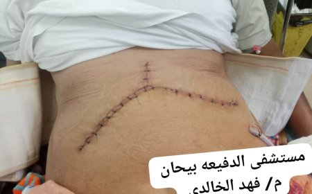 عميلة نادرة تنقذ حياة مريض في دقيقة فاصلة