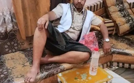 خرج مسرعًا بعد الإفطار، لم يكن يعلم أن هذه ستكون ليلته الأخيرة .. حسين محمد قاسم القطيبي، مواطن خرج ليعبئ وقود حافلته، لكنه لم يعد إلى بيته