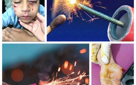 خطورة اللعب بالقريح والطماش والمفرقعات