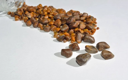 حسام موافي يكشف طريقة علاج حصوات المرارة. 