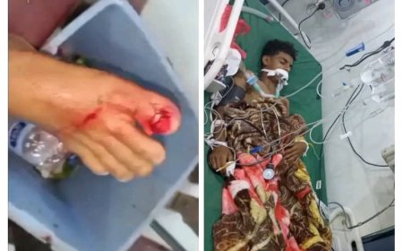 وفاة شاب من أبناء ردفان بعد إصابة قدمه بجرح من حديد مذحل ونقله إلى مستشفى النقيب