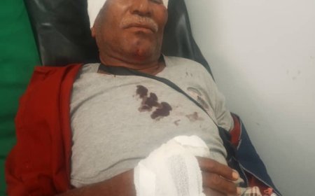 تعرض عضو إنتقالي أبين يسلم بالشرم لحادثٍ مروريٍّ مؤسف..