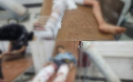 إصابة طفلان برصاص قناص حوثي بمدينة تعز