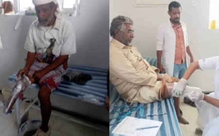 فريق طبي يركب أطرافًا صناعية لـ 20 مريضًا من منتسبي جمعية رعاية وتأهيل المعاقين بشبوة