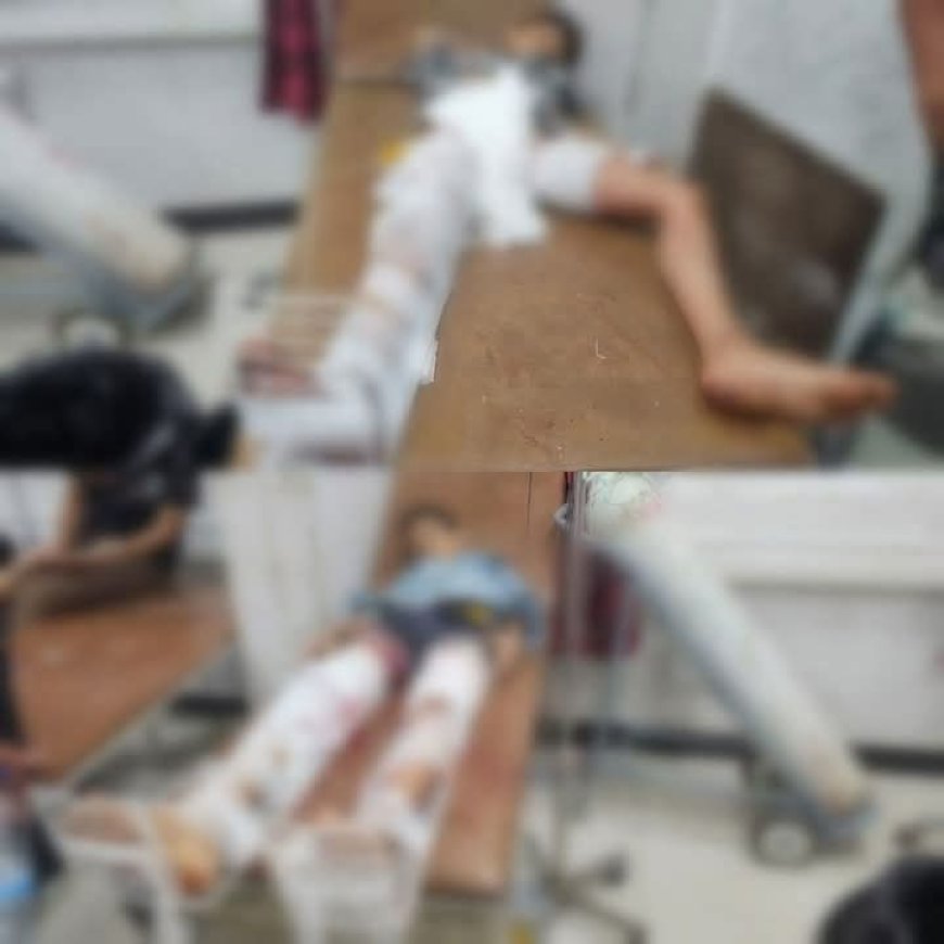 إصابة طفلان برصاص قناص حوثي بمدينة تعز