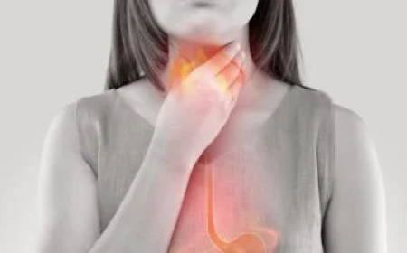 طبيب أمريكي يكشف عن علاج بسيط لحرقة المعدة في دقائق
