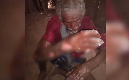 الحديدة.. حريق منزل يسفر عن وفاة طفلة وإصابة آخرين في الخوخة