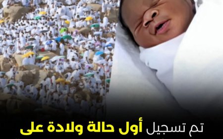 أول حالة ولادة لسيدة من توغو على جبل عرفات (صور) 