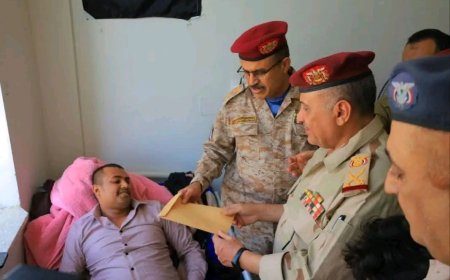 قيادة محور تعز تزور الجرحى بهيئة مستشفى الثورة العام