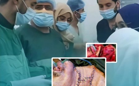 عملية جراحية معقدة في مستشفى الجمهوري تستأصل ورمًا متقدمًا في قاع الفم