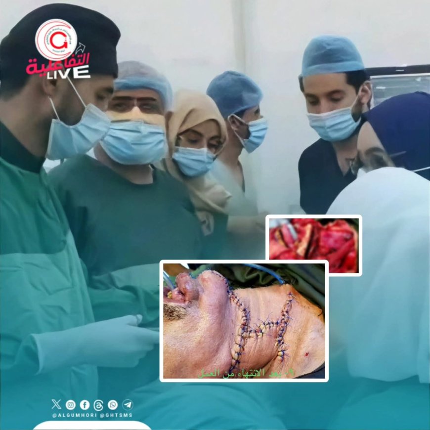 عملية جراحية معقدة في مستشفى الجمهوري تستأصل ورمًا متقدمًا في قاع الفم