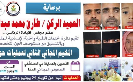 أكثر من 150 عملية مجانية ناجحة في مخيم طبي لجراحة حَوَل العين في المخا.