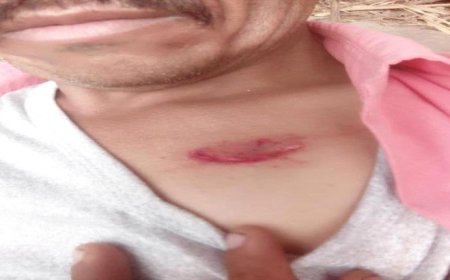 الضالع.. كلاب مسعورة تهاجم سكان الأزارق.. إصابات خطيرة تنقل إلى عدن والتحذيرات تتصاعد