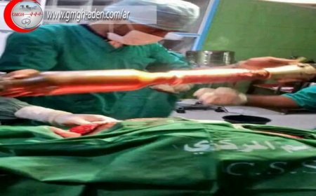 جريح بلا تقدير: قصة مقاوم يمني صُنفت إصابته ثاني أغرب إصابة في العالم… ثم تم نسيانه