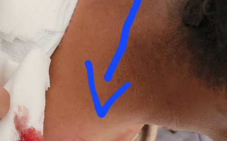 إصابة جندي برصاصة قناص حوثي في جبهة مريس بالضالع
