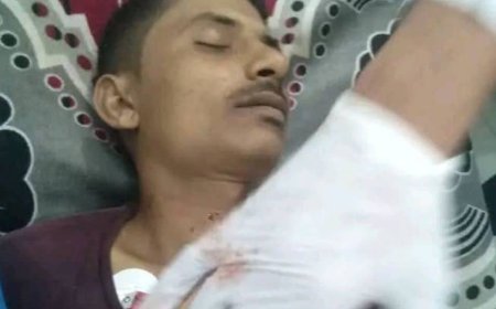 تعز.. جريمة وحشية تهز عزلة الأخمور .