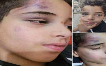 جريمة مروعة بحق الطفل ضياء في صنعاء.. تفاصيل مؤلمة