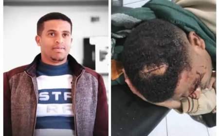 تعز.اعتداء غادر يستهدف الإعلامي محمد الحمادي خلال عودته إلى منزله